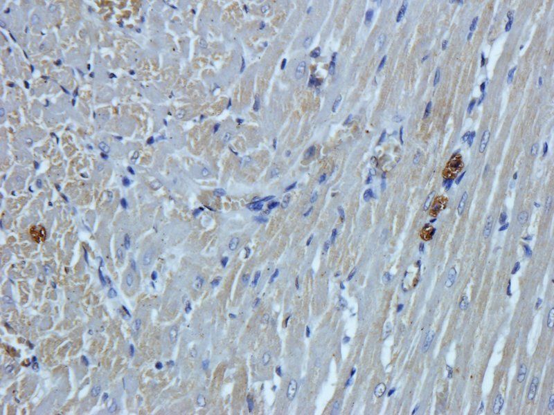 HEPCIDIN antibody