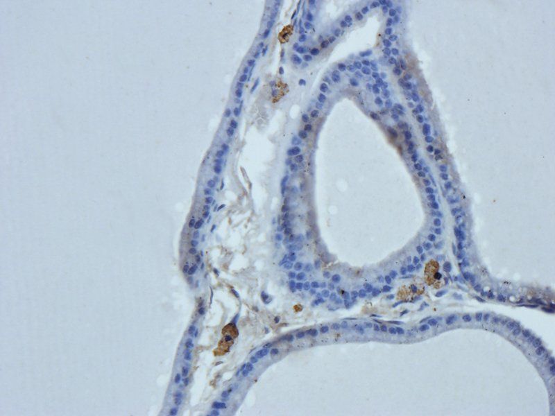 HEPCIDIN antibody