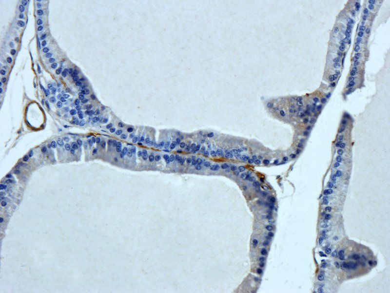 HEPCIDIN antibody
