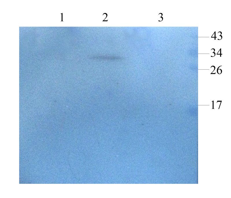HEPCIDIN antibody