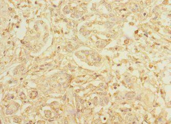 HEPH Antibody