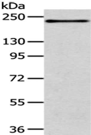 ERBB2 Antibody