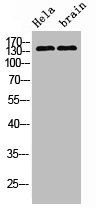 ERBB2 Monoclonal Antibody