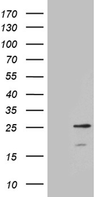 Her2 Antibody