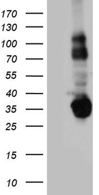 Her2 Antibody