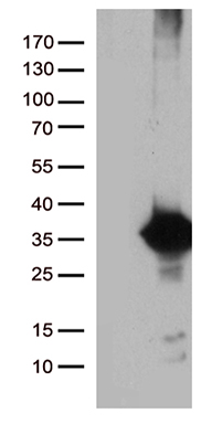 Her2 Antibody