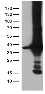 Her2 Antibody
