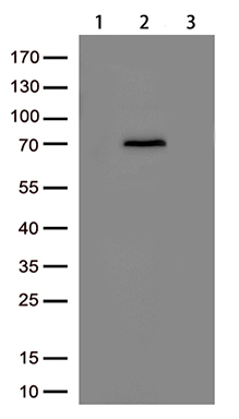 Her2 Antibody