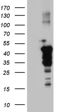 Her2 Antibody