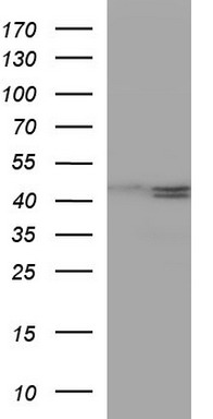 Her2 Antibody