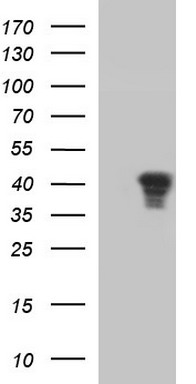 ERBB2 Antibody