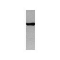 Her2 Antibody