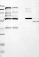 Her2 Antibody
