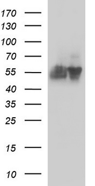 Her2 Antibody