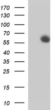 Her2 Antibody