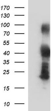Her2 Antibody