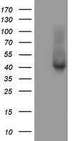 Her2 Antibody