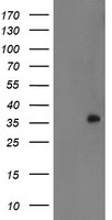 ERBB2 Antibody
