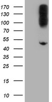 ERBB2 Antibody