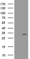 ERBB2 Antibody
