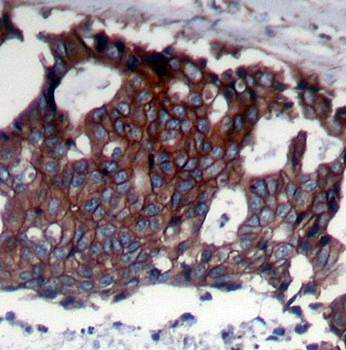 HER2 (Ab248) Antibody