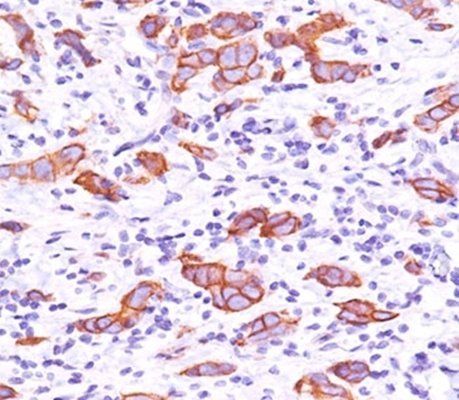 HER2 Antibody / ErbB2