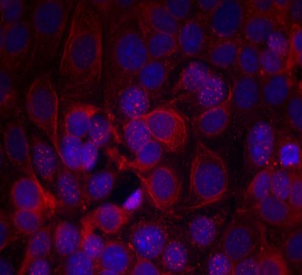 HER2 (Phospho-Tyr1221/Tyr1222) Antibody