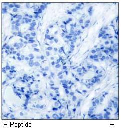 HER2 (Phospho-Tyr1248) Antibody