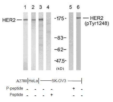 HER2 (Phospho-Tyr1248) Antibody