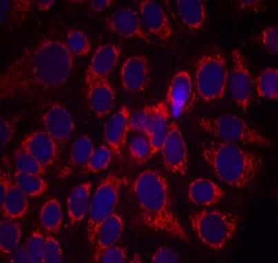 HER2 (Phospho-Tyr1248) Antibody