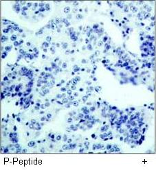 HER2 (Phospho-Tyr877) Antibody