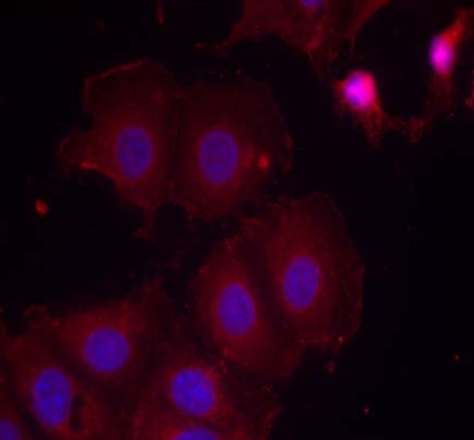 HER2 (Phospho-Tyr877) Antibody