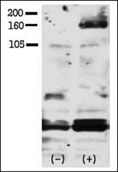 HER4 (phospho-Tyr1188) antibody