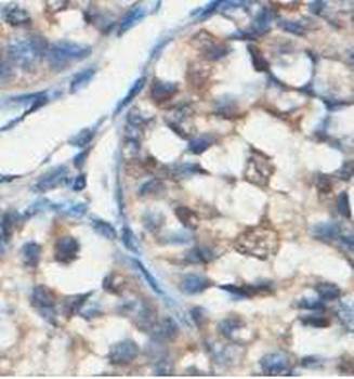 HERC4 Rabbit Polyclonal Antibody