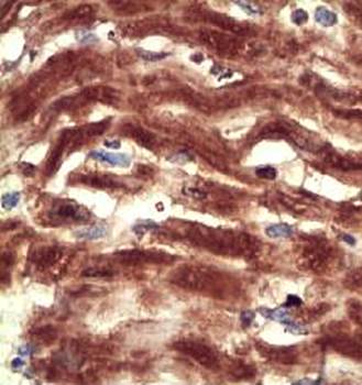 KCNH2 Rabbit Polyclonal Antibody