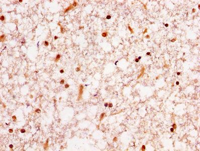 HNRNPA1 Antibody