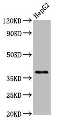 Heterogeneous nuclear ribonucleoprotein A1 antibody