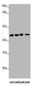 Heterogeneous nuclear ribonucleoprotein A1 antibody