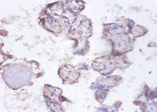 Heterogeneous nuclear ribonucleoprotein Q antibody