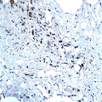 HEV ORF3 Rabbit Polyclonal Antibody