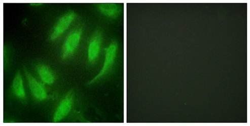 HEXIM1 Antibody
