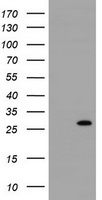 HK2 Antibody