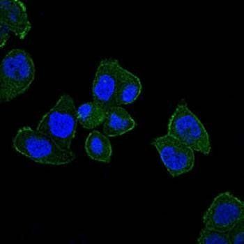 HFE Antibody