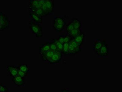 HGD Antibody