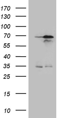 HGF Antibody