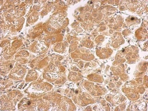 HHIP antibody [N3C2], Internal