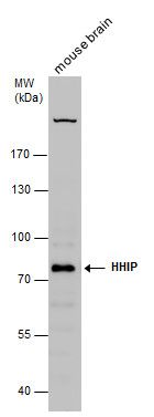 HHIP antibody