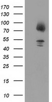 HIBCH Antibody