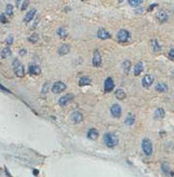 HIBCH Rabbit Polyclonal Antibody
