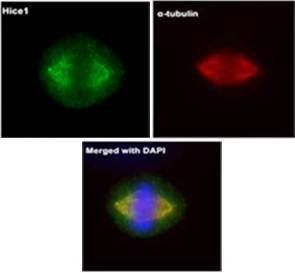 HICE1 Rabbit Polyclonal Antibody